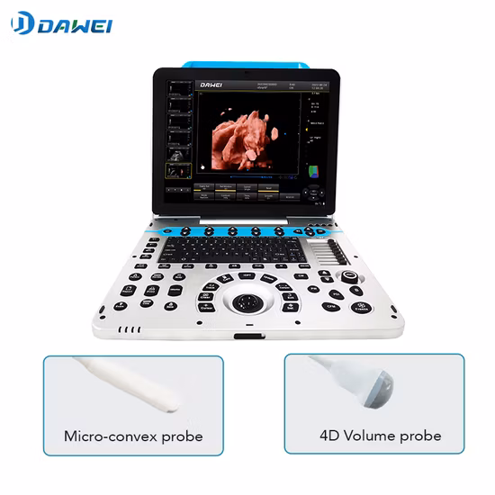 Chison Ebit50 4D 5D Système d'imagerie dianostique numérique Doppler couleur portable Gynécologie à ultrasons humains, Machine d'écho cardiovasculaire
